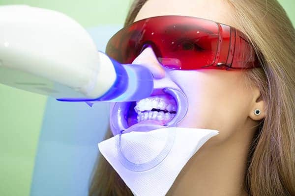 Laser teeth whitening treatments Cambridgeshire