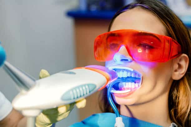 Simplifying Teeth Whitening: A Comprehensive Guide Cambridgeshire