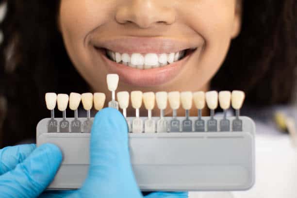 Laser Teeth Whitening: Exploring the Longevity of Your Brighter Smile Cambridgeshire