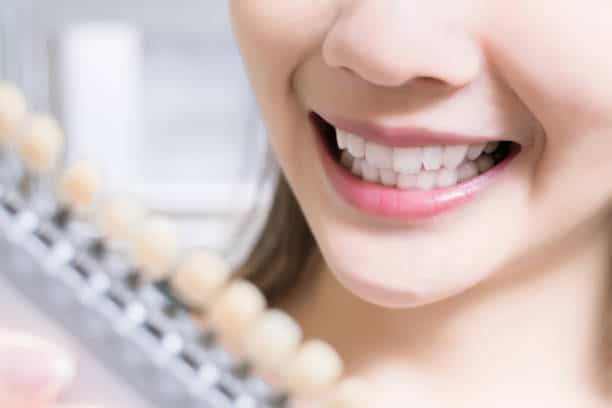 Teeth Whitening Kings Norton Cambridgeshire