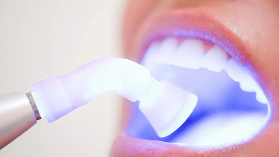 Teeth Whitening Aylesbury Cambridgeshire